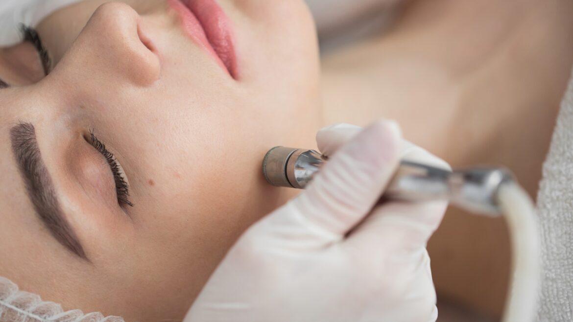 Diamond Dermabrasion Skin Procedure